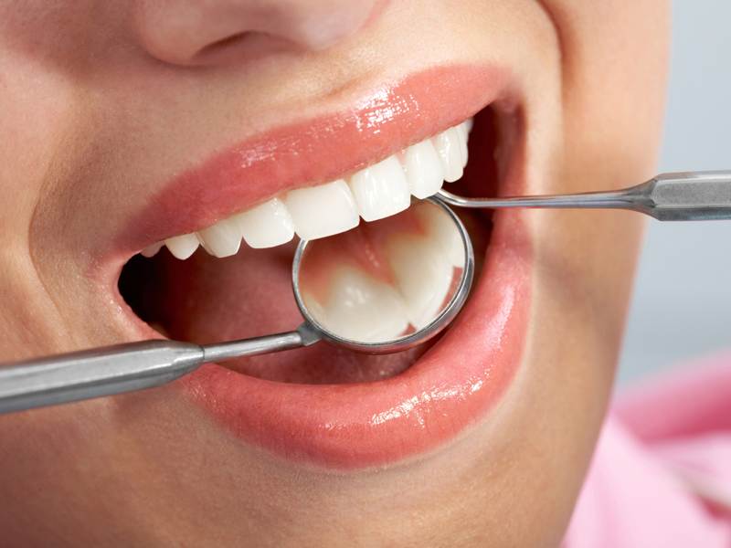 Conheça a maneira segura de ter dentes brancos e outros cuidados importantes para preservar sua boca saudável